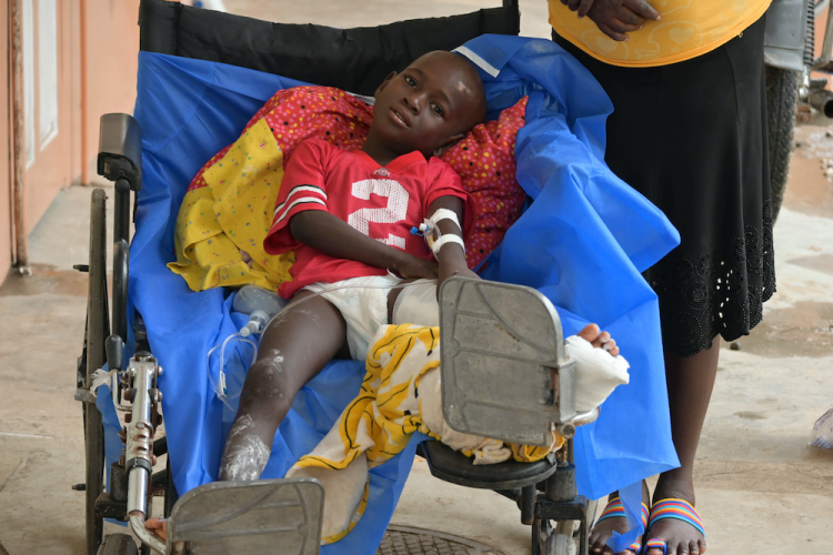 A young boy sits in a wheelchair with his left leg held up. He sits on a dark blue blanket. He wears a red shirt and his left leg is bandaged.