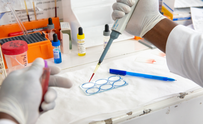 In a laboratory with vials of different colors, a technician prepares a blood test. Close-up of gloved hands.