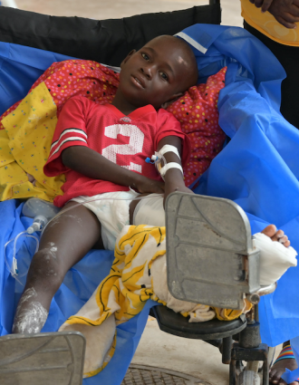 A young boy sits in a wheelchair with his left leg held up. He sits on a dark blue blanket. He wears a red shirt and his left leg is bandaged.